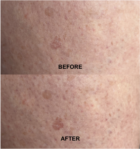 Body skin before and after using Goddess of Youth